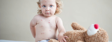 Unicef alerta: 21,1 millones de niños no se vacunaron contra el sarampión en los últimos ocho años