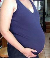 La hemorragia postparto