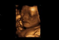 Los fetos bostezan en el vientre materno 