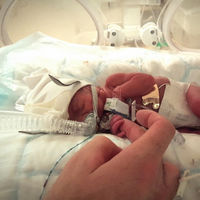 Nacer microprematuro: vino al mundo con 27 semanas y 745 gramos y ha logrado sobrevivir