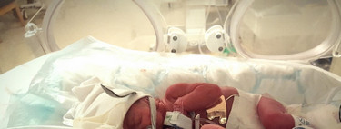 Nacer microprematuro: vino al mundo con 27 semanas y 745 gramos y ha logrado sobrevivir