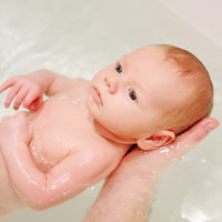 La costra láctea del recién nacido: qué es y cuándo hay que tratarla