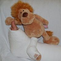 Fracturas de huesos en los niños