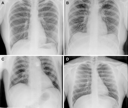 radiografia
