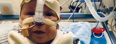 Nació con 23 semanas y 700 gramos, y a pesar de muchísimas complicaciones, logró salir adelante