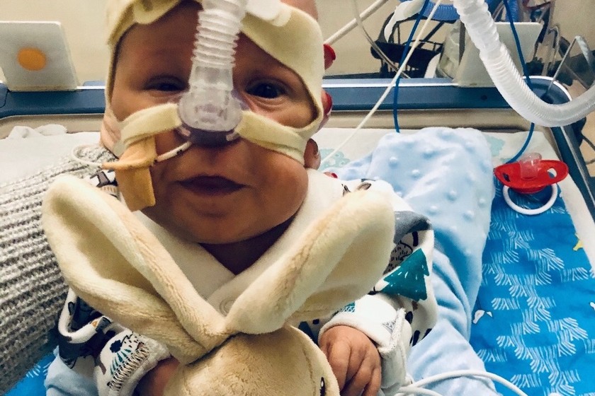 Nacio Con 23 Semanas Y 700 Gramos Y A Pesar De Muchisimas Complicaciones Logro Salir Adelante