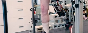 O fim da prótese artificial: a fusão de osso, músculo e chip que está criando o primeiro "membro ciborgue" da vida real 