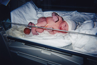 Bebés en situación de riesgo para su desarrollo