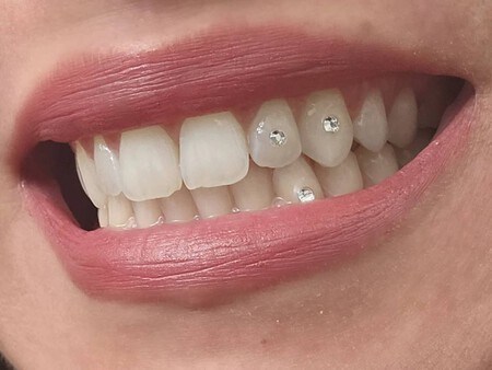 Tooth Gems