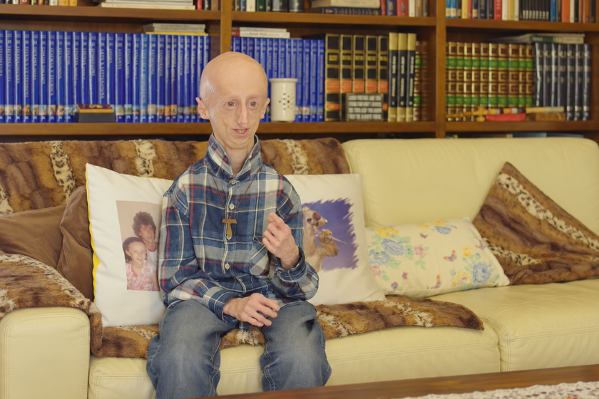 Sammy Basso advanced progeria research and treatments