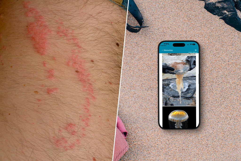 Una picadura de medusa arruinó mis vacaciones. Me prometí que no volvería a pasar y ahora siempre llevo esta app en mi iPhone Una picadura de medusa arruinó mis vacaciones. Me prometí que no volvería a pasar y ahora siempre llevo esta app en mi iPhone