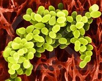 Super bacterias, una nueva amenaza entre la población infantil