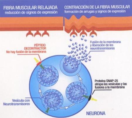 Qué hago con mis arrugas de expresión