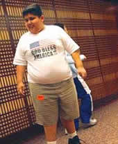 ¿Campamento de verano contra la obesidad?