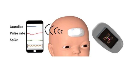 El primer wearable para bebés que monitorea con precisión la ictericia, algo que afecta a la mayoría de neonatos