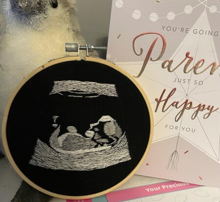 Un futuro papá ciego pudo 'ver' la primera ecografía de su bebé gracias a un bordado
