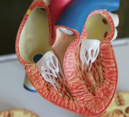Arteorioesclerosis: causas, síntomas y tratamiento