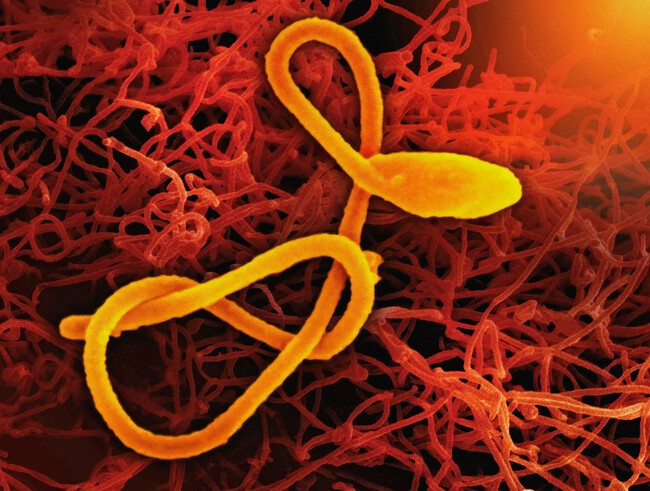 Ebola