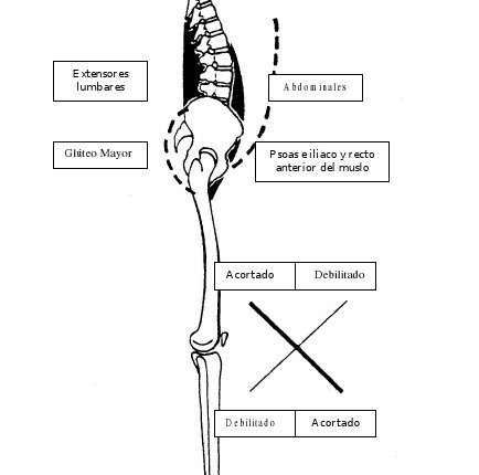 Síndrome cruzado inferior a causa de desequilibrios musculares