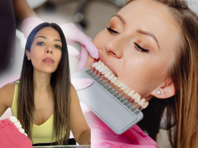 Blanqueamiento Dental