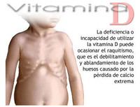 El raquitismo infantil