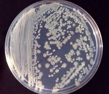 En la Estación Espacial Internacional hay organismos infecciosos como en los hospitales