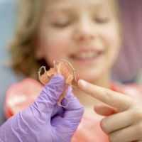 Preguntas frecuentes sobre niños y ortodoncia (o qué pasa cuando los dientes salen desordenados)