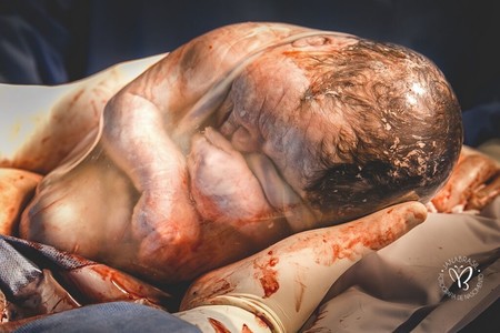 fotos-ganadoras-parto-2020