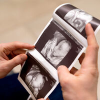 Ser madre o padre trans: preservación de la fertilidad y embarazo en personas transexuales