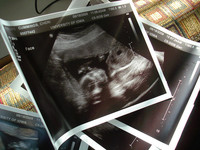 Ecografía del tercer trimestre