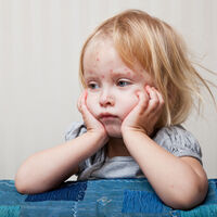 Las muertes por sarampión aumentan en 50 por ciento en cuatro años, advierte la OMS: la importancia de vacunar a los niños