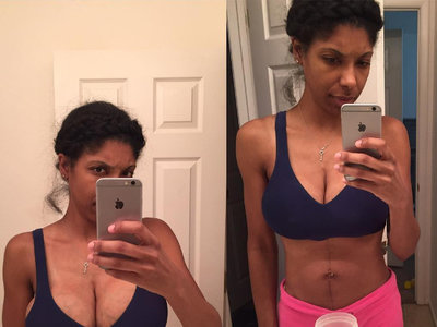 La increíble diferencia de los pechos de una mujer antes y después de sacarse leche 