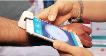 MoleScope te permite vigilar los lunares de la piel para prevenir melanomas