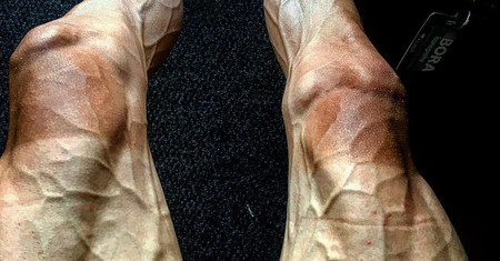 Así quedan las piernas de un ciclista tras 16 etapas del Tour de Francia