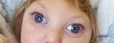 La increíble historia de Jaxon, el bebé que cumplió dos años a pesar de faltarle la mayor parte de su cerebro