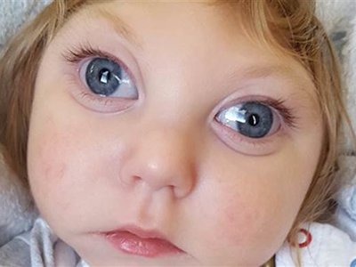 La increíble historia de Jaxon, el bebé que cumplió dos años a pesar de faltarle la mayor parte de su cerebro