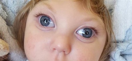 La increíble historia de Jaxon, el bebé que cumplió dos años a pesar de faltarle la mayor parte de su cerebro