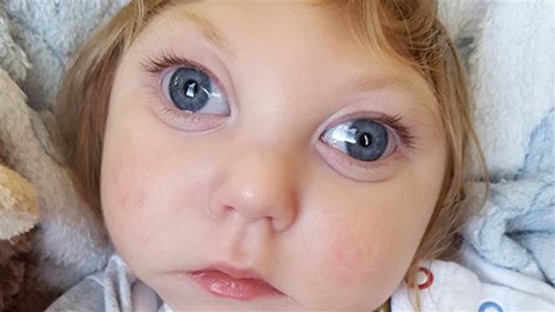 La increíble historia de Jaxon, el bebé que cumplió dos años a pesar de faltarle la mayor parte de su cerebro