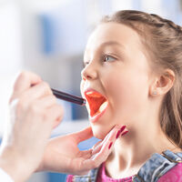 La faringitis bacteriana se asocia a mayor impulsividad e hiperactividad en los niños, pero no empeora sus tics