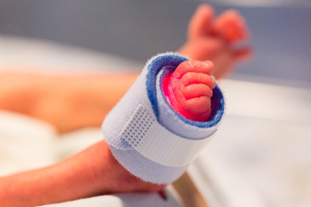 Nace por cesárea el primer bebé prematuro libre de coronavirus de una embarazada infectada