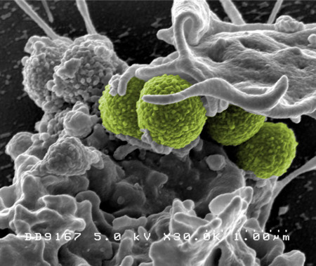 Todos tenemos una nube de bacterias que nos rodea y nos define