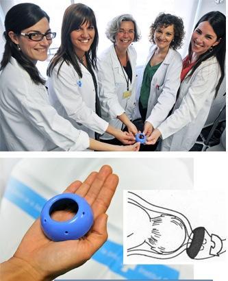 Un anillo de silicona en el útero reduce los partos prematuros