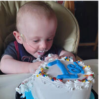 El bebé más prematuro del mundo según el Guinness de los Récords cumple su primer año: nació con 21 semanas y 340 gramos de peso