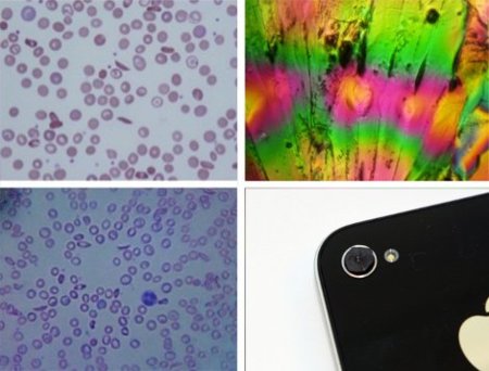 ¿Tienes un iPhone y 20 dólares? Ya tienes un microscopio