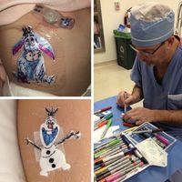 Dibujar personajes de Disney o superhéroes en los apósitos de los niños: la iniciativa de un cirujano pediátrico para animarles