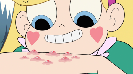 S2e10 Star Butterfly Looks At Her Mosquito Bites