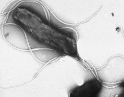 Orígenes de la bacteria causante de la úlcera de estómago