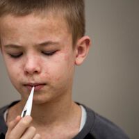 México tiene un problema gigantesco contra el sarampión: los adultos jóvenes ya no están protegidos 