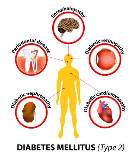 Más estudios a favor del HIIT para mejorar nuestra salud