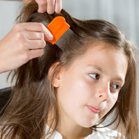 ¡Mi hijo tiene piojos!: nueve pasos para acabar con ellos definitivamente